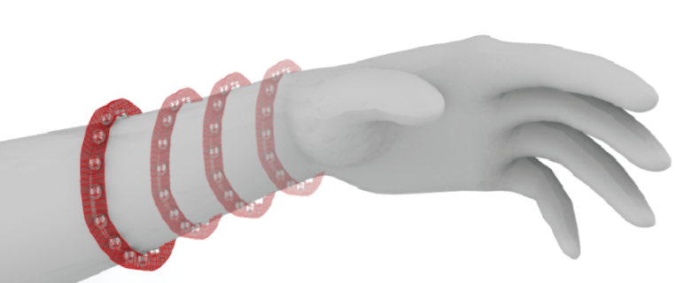 Moving electrode configuration